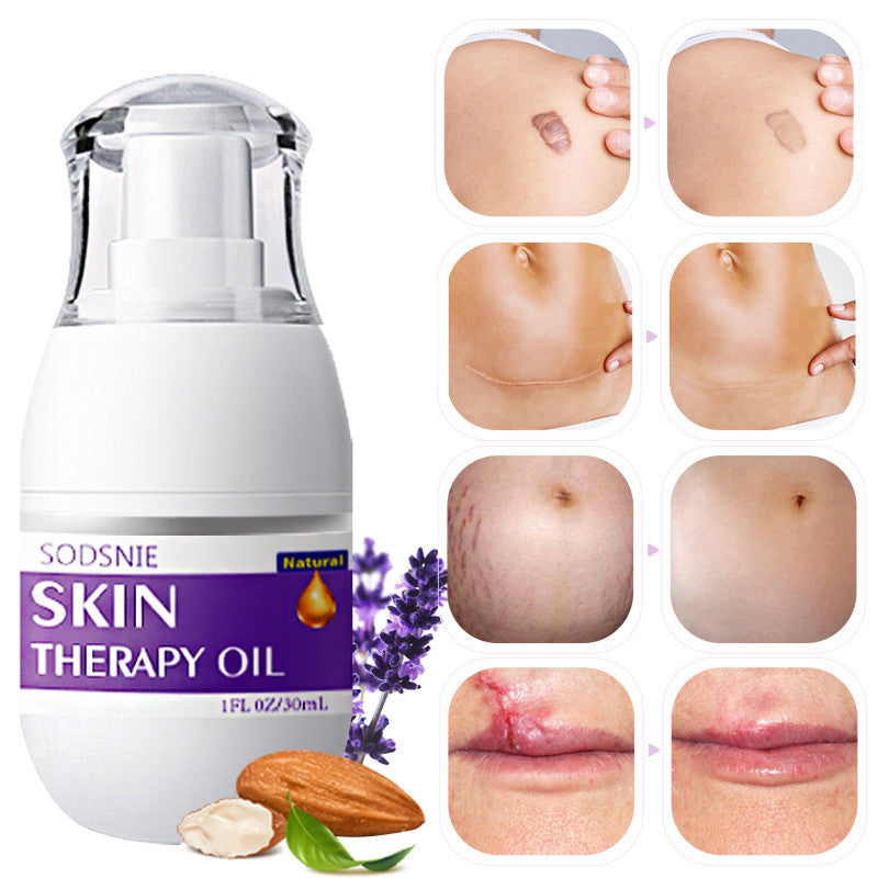 Skin Treatment Oil Remove Puncture Cellulite Stretch Mark Repair Body 